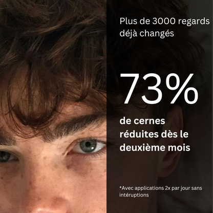 Soin Helios™ Anti-Cernes pour Hommes